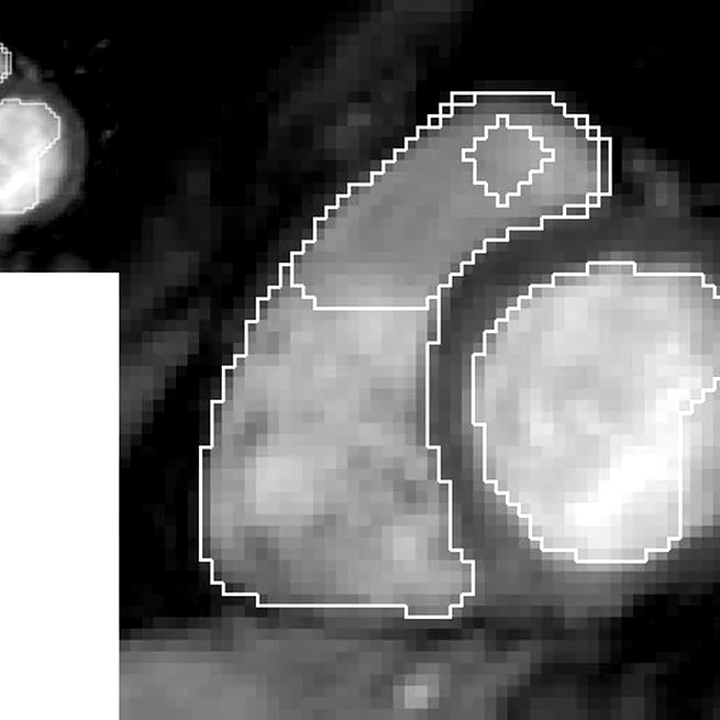 Discrete deformable boundaries for the segmentation of multidimensional images
