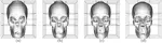 Deformable Meshes with Automated Topology Changes for Coarse-to-fine 3D Surface Extraction